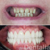 Специалисты клиники «Денталия» помогут вернуть стоматологическое здоровье и  красивую улыбку